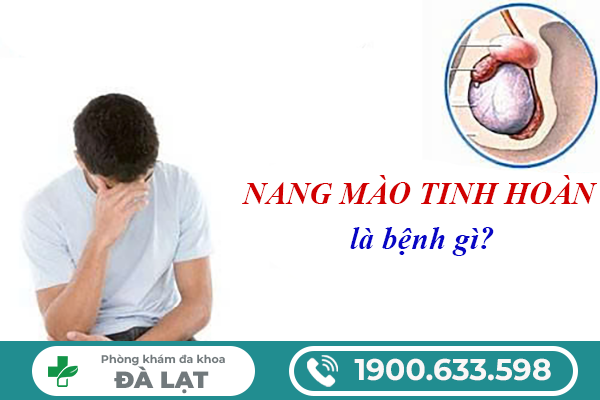 Hình ảnh minh họa